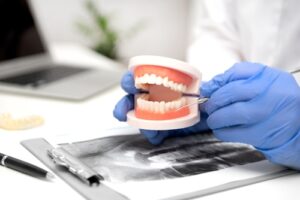 Dentist,Shows,Problem,Areas,In,Teeth