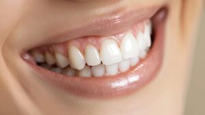 white smile