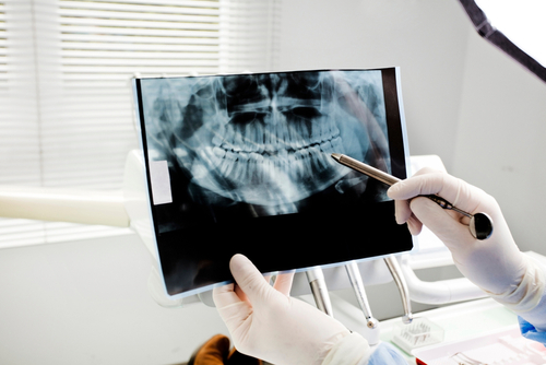 Dental,Doctor,,Oral,X-ray,Exams