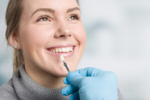 Dentist,Using,Shade,Guide,At,Woman's,Mouth