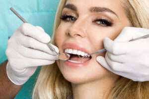 woman with veneers